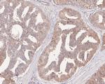 DPP3 Antibody in Immunohistochemistry (Paraffin) (IHC (P))