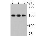 Collagen III Antibody in Western Blot (WB)