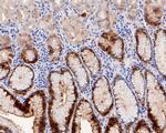 15-PGDH Antibody in Immunohistochemistry (Paraffin) (IHC (P))