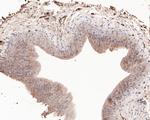 15-PGDH Antibody in Immunohistochemistry (Paraffin) (IHC (P))