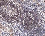 CD79b Antibody in Immunohistochemistry (Paraffin) (IHC (P))