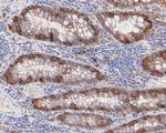 CTNNBIP1 Antibody in Immunohistochemistry (Paraffin) (IHC (P))