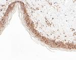 CTNNBIP1 Antibody in Immunohistochemistry (Paraffin) (IHC (P))