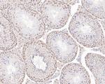 PDCD7 Antibody in Immunohistochemistry (Paraffin) (IHC (P))