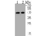 ACAT2 Antibody in Western Blot (WB)