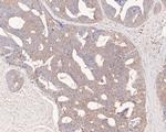 FKTN Antibody in Immunohistochemistry (Paraffin) (IHC (P))