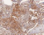 ARPC2 Antibody in Immunohistochemistry (Paraffin) (IHC (P))