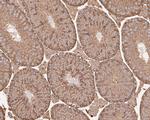 ARPC2 Antibody in Immunohistochemistry (Paraffin) (IHC (P))