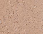 ARPC2 Antibody in Immunohistochemistry (Paraffin) (IHC (P))