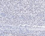 CPSF3 Antibody in Immunohistochemistry (Paraffin) (IHC (P))