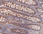 ABH1 Antibody in Immunohistochemistry (Paraffin) (IHC (P))