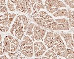 USP24 Antibody in Immunohistochemistry (Paraffin) (IHC (P))