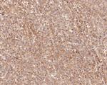 USP24 Antibody in Immunohistochemistry (Paraffin) (IHC (P))