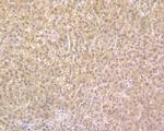 NUDT5 Antibody in Immunohistochemistry (Paraffin) (IHC (P))