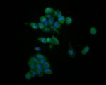 HDGF Antibody in Immunocytochemistry (ICC/IF)