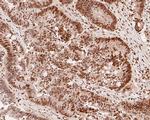 HDGF Antibody in Immunohistochemistry (Paraffin) (IHC (P))