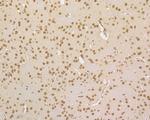 HDGF Antibody in Immunohistochemistry (Paraffin) (IHC (P))