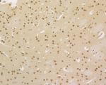 HDGF Antibody in Immunohistochemistry (Paraffin) (IHC (P))