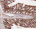 HDGF Antibody in Immunohistochemistry (Paraffin) (IHC (P))