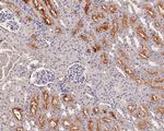 SUOX Antibody in Immunohistochemistry (Paraffin) (IHC (P))