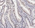 MED4 Antibody in Immunohistochemistry (Paraffin) (IHC (P))