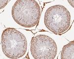 MED4 Antibody in Immunohistochemistry (Paraffin) (IHC (P))