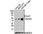 GNAS Antibody in Western Blot (WB)