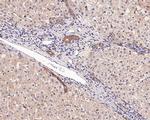 ACSL3 Antibody in Immunohistochemistry (Paraffin) (IHC (P))