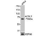 ACSL3 Antibody in Western Blot (WB)