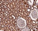 C1QBP Antibody in Immunohistochemistry (Paraffin) (IHC (P))