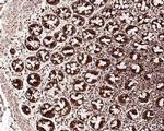 C1QBP Antibody in Immunohistochemistry (Paraffin) (IHC (P))