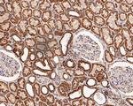 C1QBP Antibody in Immunohistochemistry (Paraffin) (IHC (P))