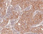 TCP-1 delta Antibody in Immunohistochemistry (Paraffin) (IHC (P))