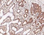 TCP-1 delta Antibody in Immunohistochemistry (Paraffin) (IHC (P))