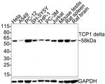 TCP-1 delta Antibody in Western Blot (WB)