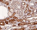 CD161 Antibody in Immunohistochemistry (Paraffin) (IHC (P))