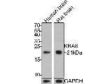 K-Ras Antibody in Western Blot (WB)