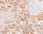 AMPK alpha-2 Antibody in Immunohistochemistry (Paraffin) (IHC (P))