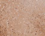 AMPK alpha-2 Antibody in Immunohistochemistry (Paraffin) (IHC (P))