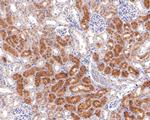 AMPK alpha-2 Antibody in Immunohistochemistry (Paraffin) (IHC (P))