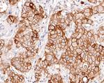 TROP2 Antibody in Immunohistochemistry (Paraffin) (IHC (P))