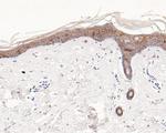 TROP2 Antibody in Immunohistochemistry (Paraffin) (IHC (P))