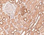 IL11RA Antibody in Immunohistochemistry (Paraffin) (IHC (P))