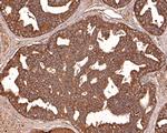 IL11RA Antibody in Immunohistochemistry (Paraffin) (IHC (P))