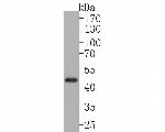 IL11RA Antibody in Western Blot (WB)