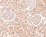 NCoR1 Antibody in Immunohistochemistry (Paraffin) (IHC (P))