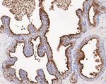 PSMA Antibody in Immunohistochemistry (Paraffin) (IHC (P))