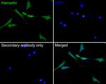 TSC1 Antibody in Immunocytochemistry (ICC/IF)