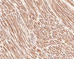 TSC1 Antibody in Immunohistochemistry (Paraffin) (IHC (P))