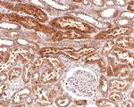 TSC1 Antibody in Immunohistochemistry (Paraffin) (IHC (P))